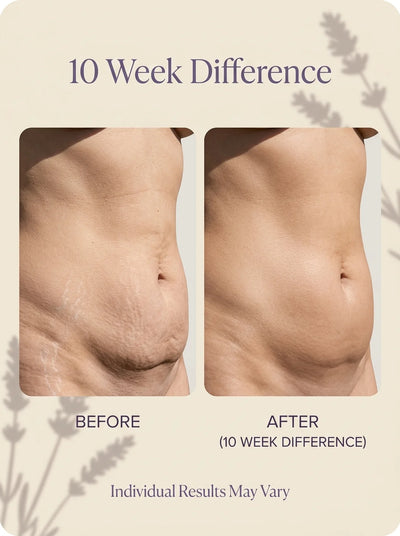 Veloura® Skin Tightening Lotion