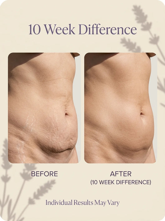 Veloura® Skin Tightening Lotion